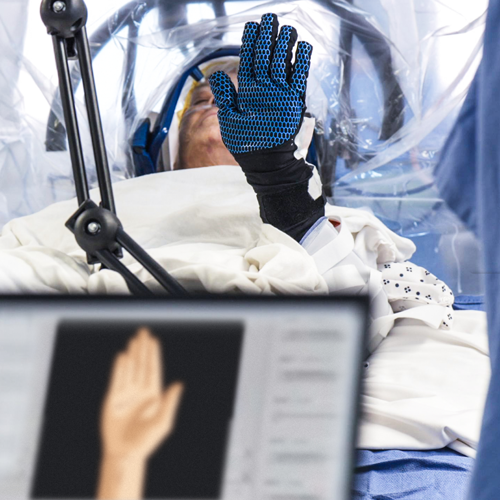 A patient on an operating table holds up a gloved hand, while a computer screen displays a graphic of a hand with the word “Success.”